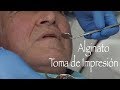 Módulo 2 Parte 1 Manejo del alginato y toma de impresión en la consulta dental