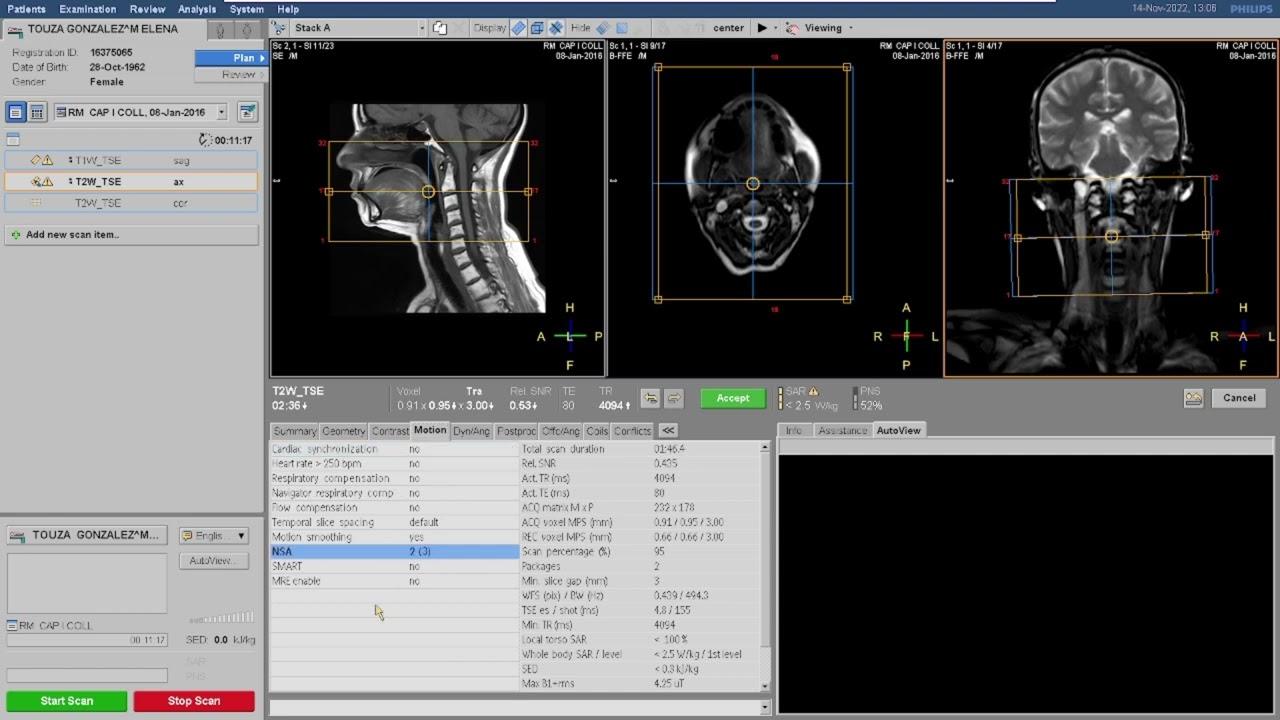 Programación cuello