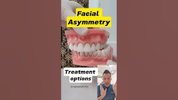 Facial Asymmetry Treatment: What Are Your Options? #dentallan #dentist #shorts