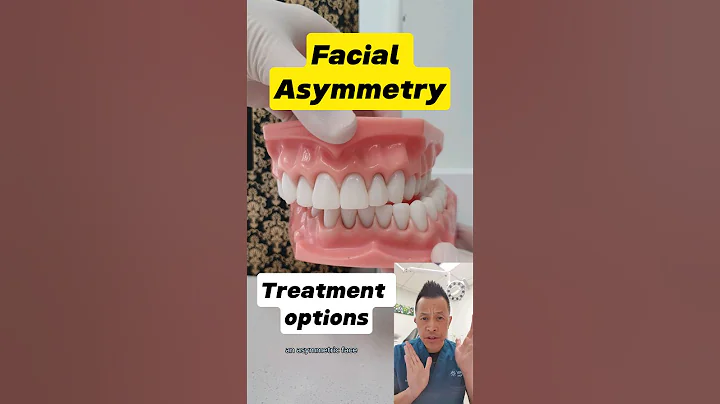 Facial Asymmetry Treatment: What Are Your Options? #dentallan #dentist #shorts