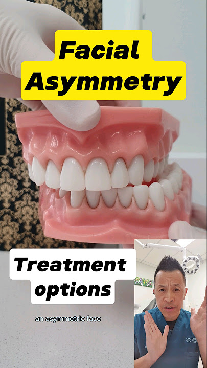 Facial Asymmetry Treatment: What Are Your Options? #dentallan #dentist #shorts