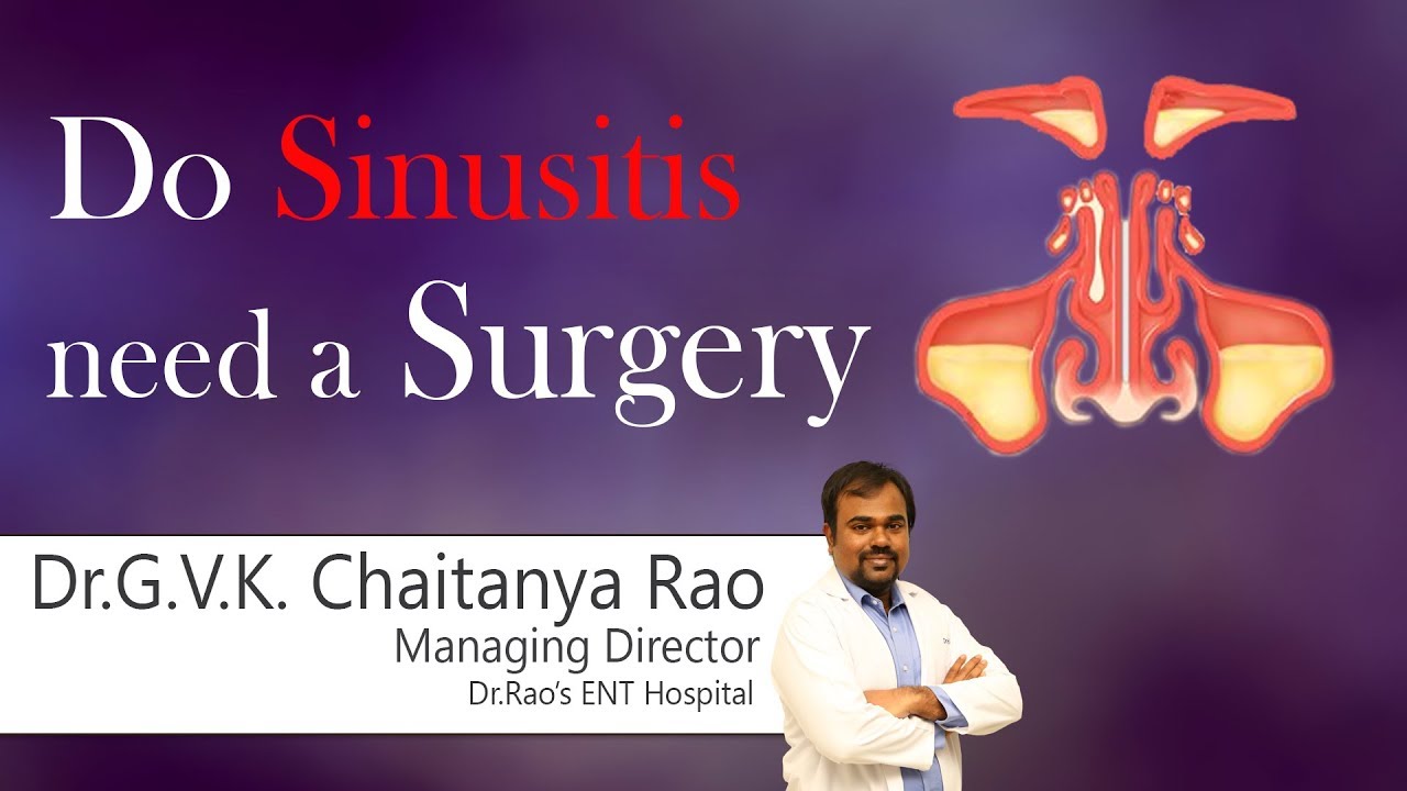 Hi9 Do Sinusitis Need A Surgery Dr G V K Chaithanya Rao Ent