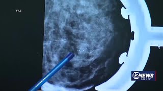 U.S. task force confirms mammograms recommendations