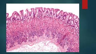 HISTOLOGIA DEL ESTOMAGO