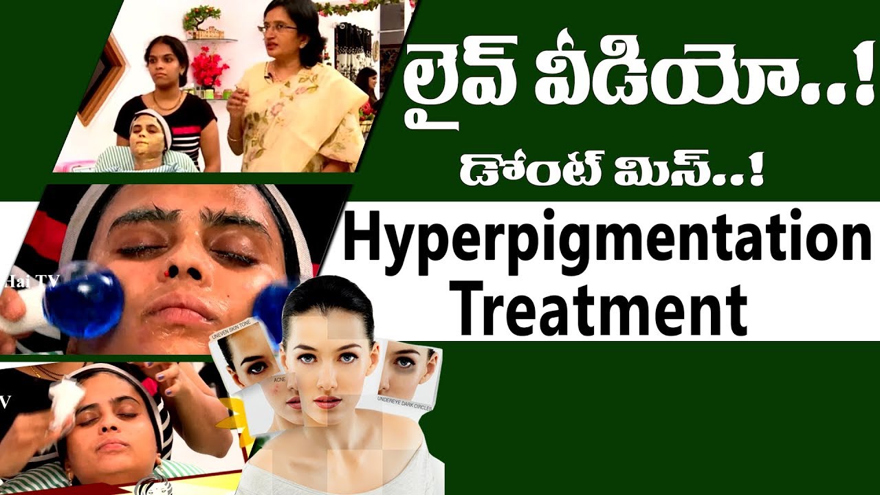 Hyperpigmentation Treatment l How to Treat Hyperpigmentation on Face-Causes of Uneven Skin l Hai TV
