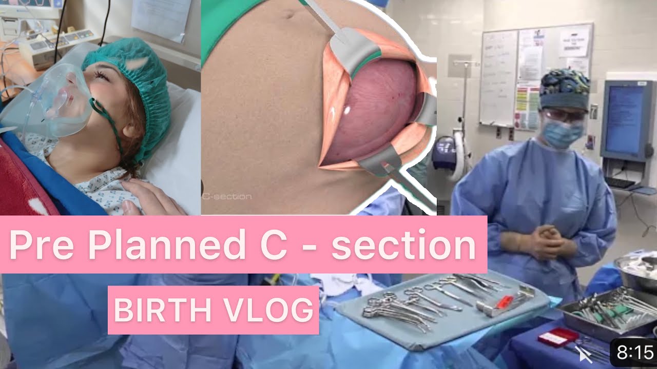 OFFICIAL BIRTH VLOG | PRE-SCHEDULED C-SECTION | what to expect ?