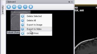 ClearCanvas Workstation: DICOM Print
