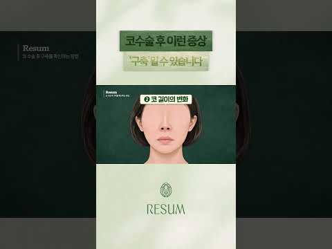 "내 코도 혹시 구축이 온 건 아닐까?" 코 성형 후 반드시 체크해야 할 3가지 증상 이미지