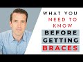 What you need to know before getting braces! | Invisalign | Dr. Nate