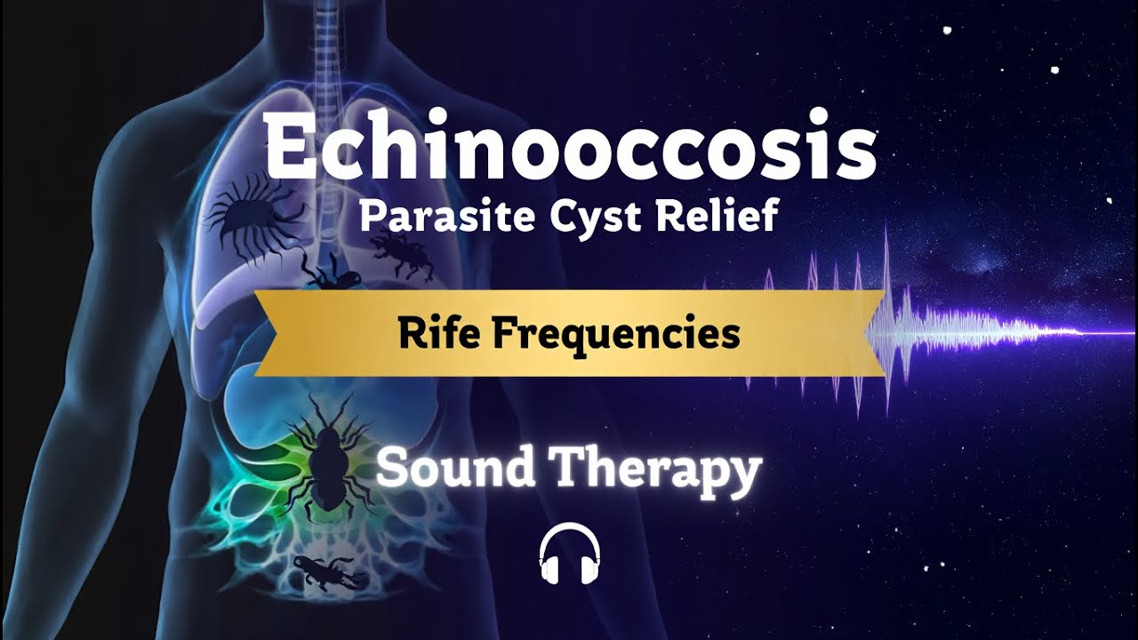 Targeting Hydatid Cysts with Rife Frequencies | Echinococcus Tapeworm Protocol