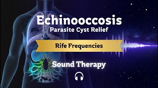 Targeting Hydatid Cysts With Rife Frequencies  Echinococcus Tapeworm Protocol