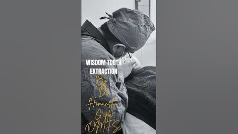 Wisdom Tooth Extraction in OSMF patient