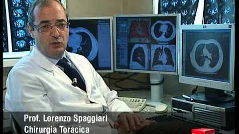 Quali sono i sintomi di un tumore ai bronchi?