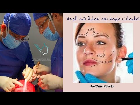أهم التعليمات التي يجب الالتزام بها بعد عملية شد الوجه للوصول لافضل النتائج دكتور ياسر الشيخ