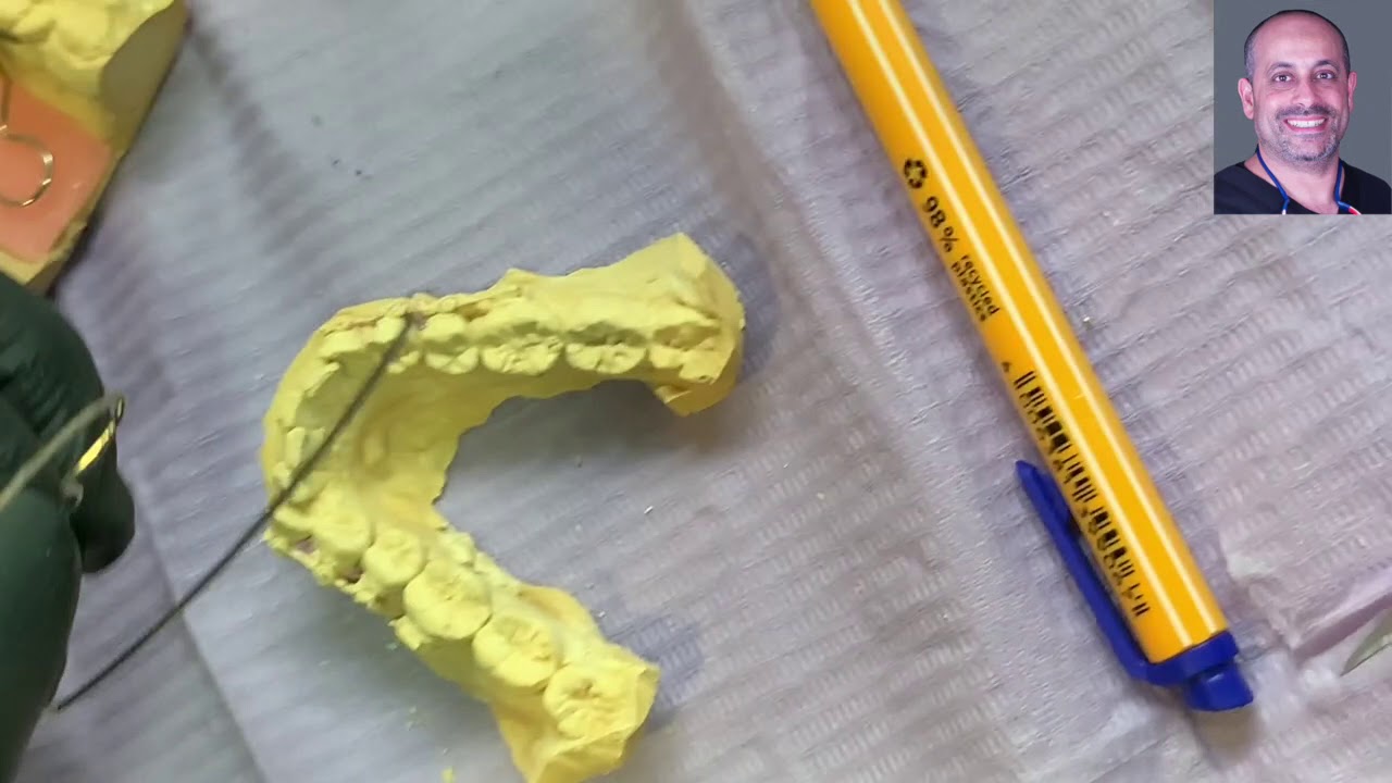 FF022: lingual arch orthodontic lab step by step useful for Paediatric dentists and orthodontists