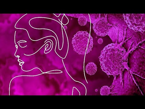 telemedicina cfm Prevención y despistaje del cáncer ginecológico. Ponencia de la Dra. Mireya González Blanco