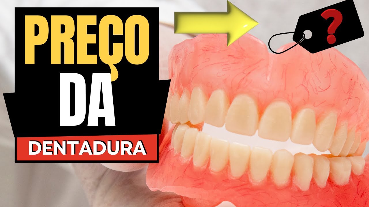 Quanto Custa uma Dentadura no Dentista