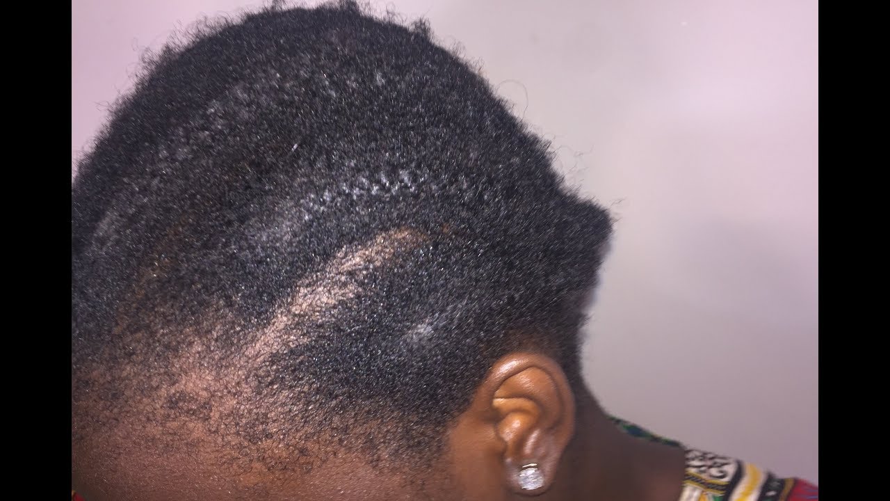 TAKING OUT 3 MONTHS OLD CORNROWS AND I LOST HAIR!!!! | EMEM ANDY - YouTube