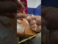 #antibiotics #injection #iv #doctor #nursing #medical #health #trendingshorts #viral #video 🩸💉