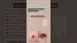 Congo Crimean Fever #crimeanfever #medicaleducation #neetpg #neet2024 #CCHF