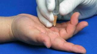 Hand Injection Techniques  Intermetacarpal Injections