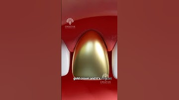 Why Do Some People Prefer Gold Tooth Over Porcelain? 🤔 #short #goldtooth- Creativelearning3d