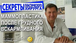 Маммопластика после грудного вскармливания. Когда можно проводит операцию? Сергей Усов