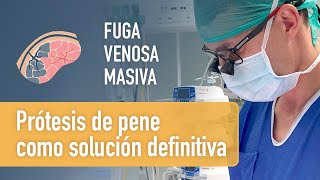 Solución A Fuga Venosa Masiva. La Prótesis De Pene. Doctor Carlos Simón