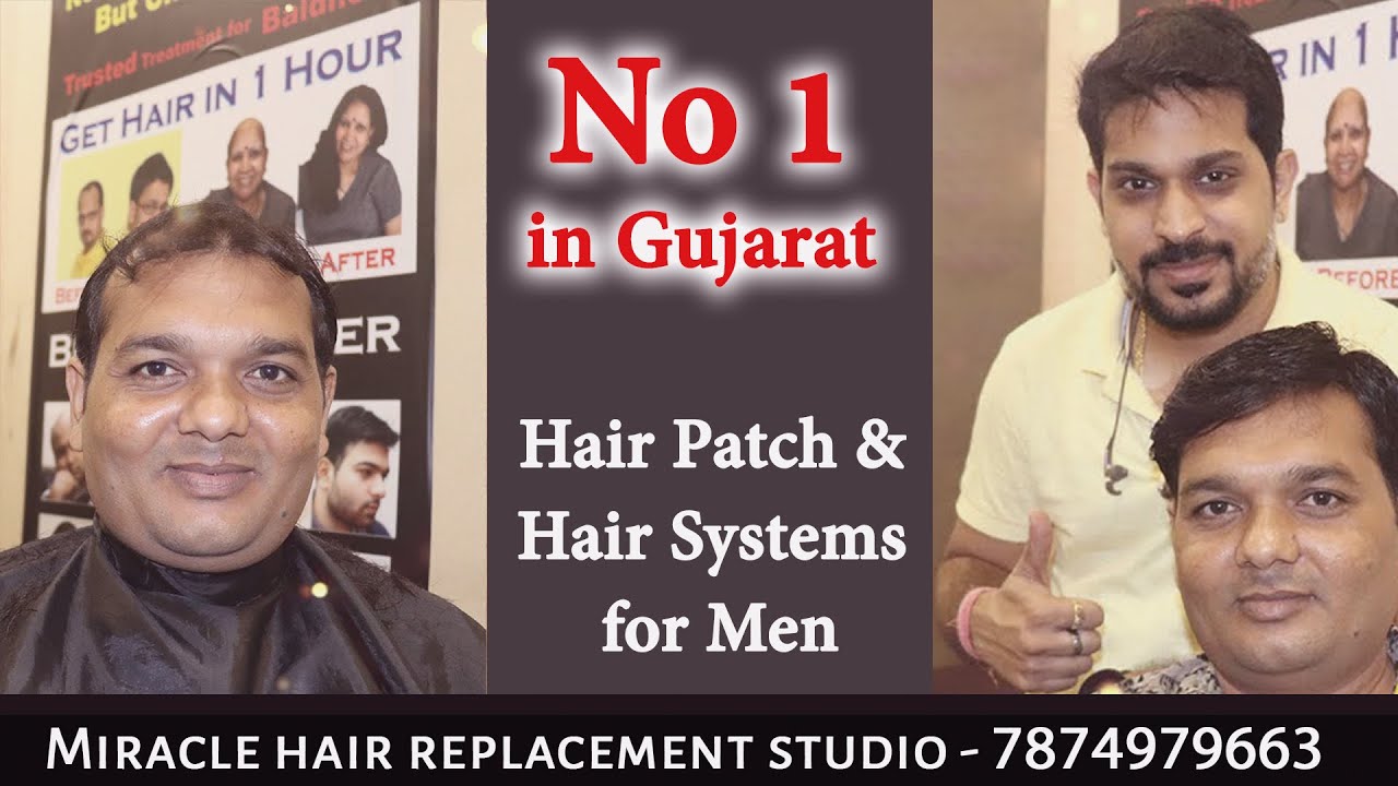 Hair patch & Hair System For men , No 1 in Gujarat | Best hair  transformation in Gujarat , Kunal Sen - YouTube