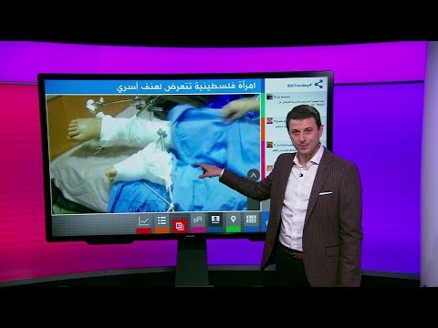 فلسطيني يهشم قدمي اخته المطلقة بمطرقة لأنها أرادت أن تعمل