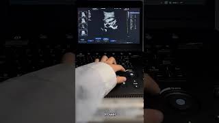 How to use Dolphi-C Ultrasound  -Part 1 Kidney