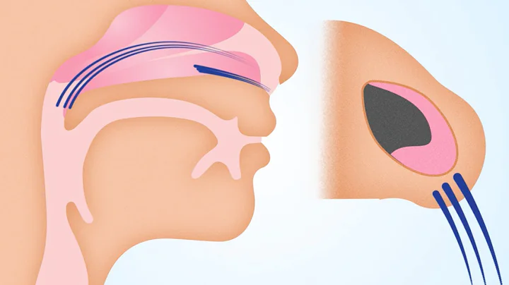 What Causes Sleep Apnea? Sinus & Snoring Specialists