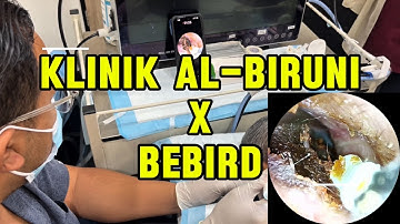 INSANE Earwax Pull Using Bebird EarSight Plus