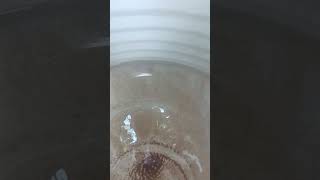 life inside a tank 🤧ye kya dekha hamne#water #microrgan #waterday