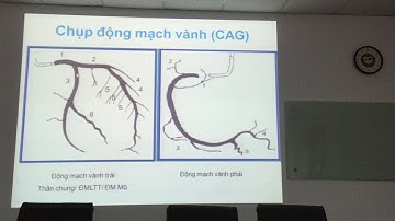 NHỒI MÁU CƠ TI CẤP BS ĐỨC HUY