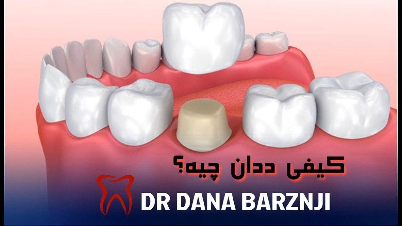 کیفی ددان چیە؟ | whats crown teeth?
