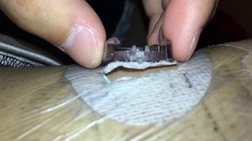 Dexcom G4 and G5 sensor removal.