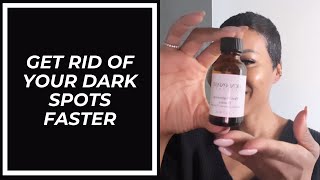 GET RID OF YOUR DARK SPOTS FASTER
