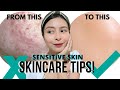 SIMPLE WAYS TO GET CLEAR SKIN! SKINCARE TIPS FOR SENSITIVE SKIN | KATH MELENDEZ