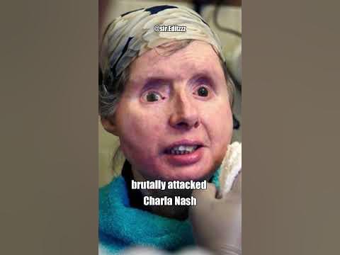 Travis Chimp Attack #shorts - YouTube