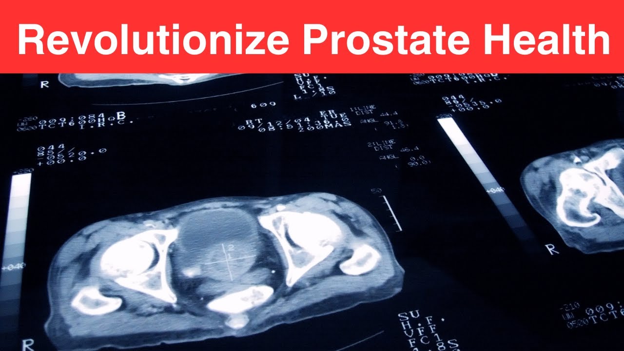 Fluxactive Complete: Complete Prostate Wellness Formula