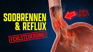 Sodbrennen & Reflux loswerden: So reparierst du das Ventil – ohne Medikamente | Vagusnerv & Gehirn