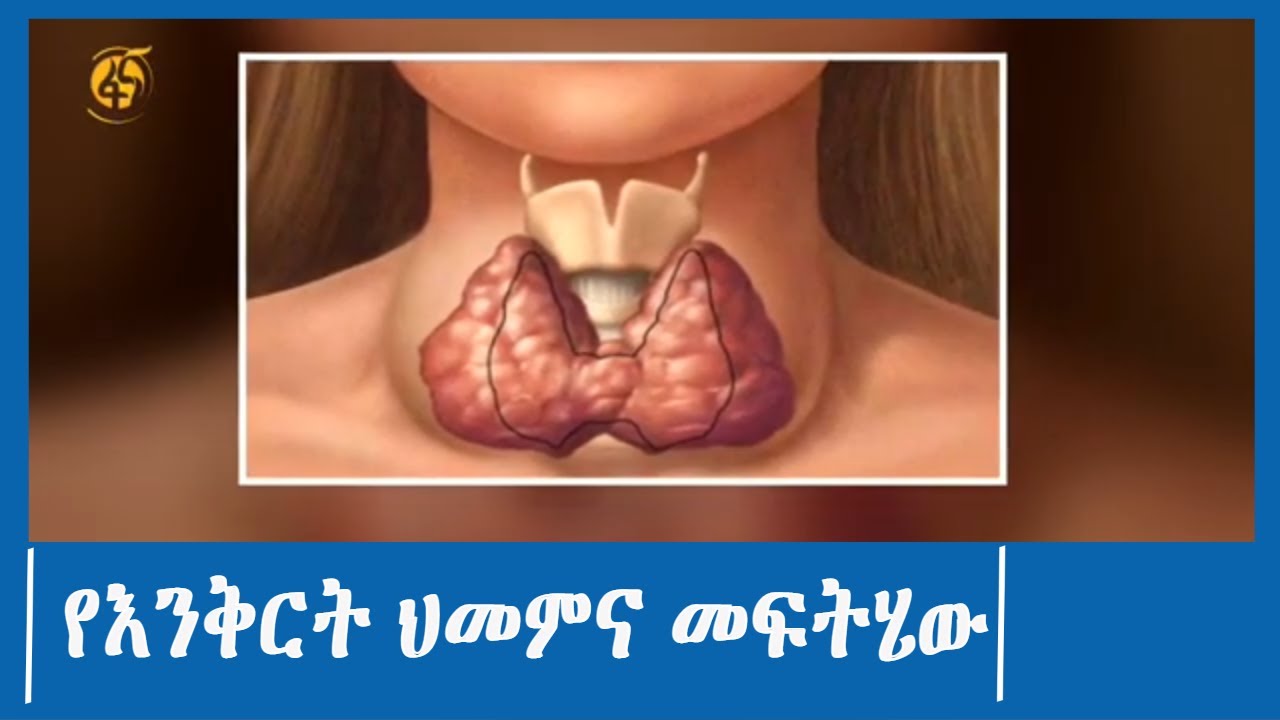 የእንቅርት ህመምና መፍትሄው