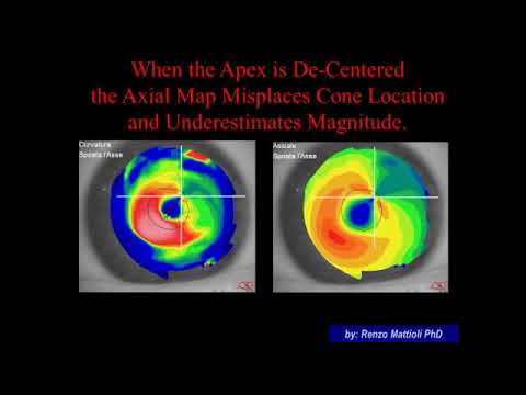 [Online Seminar] Pentacam® Online Seminar - Part 1