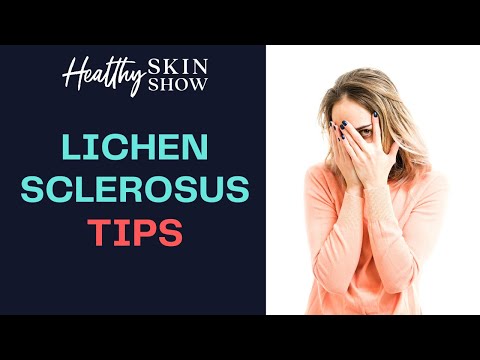 Lichen Sclerosus Help With Diet And Physical Therapy