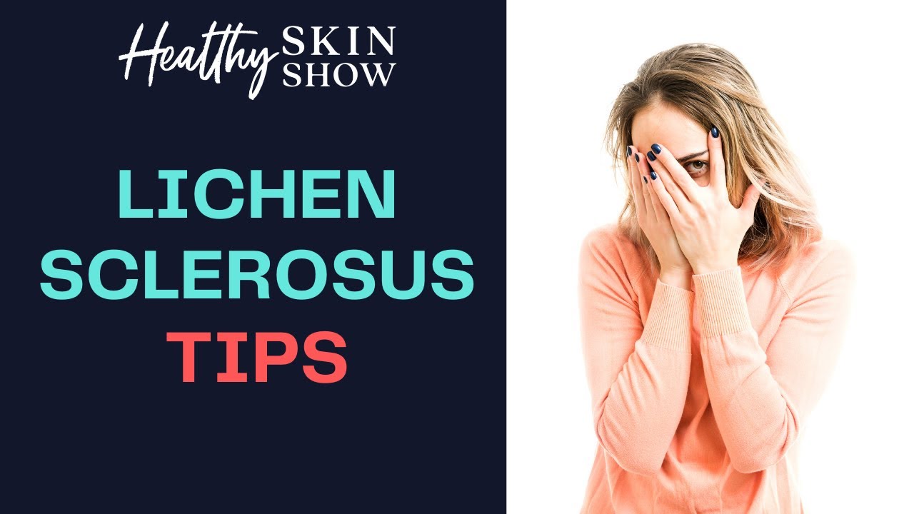 How To Manage LICHEN SCLEROSUS | Dr. Jessica Drummond
