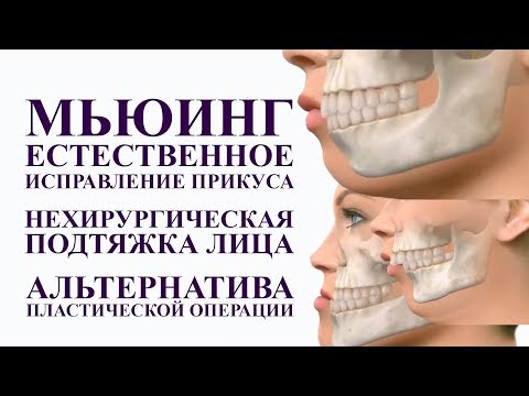 Мьюинг - СУПЕР ПРИЕМ ДЛЯ МОЛОДОСТИ ЛИЦА. Нехирургическая коррекция лица