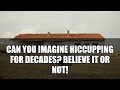5 Longest Hiccups in History That Shocked the World #shorts