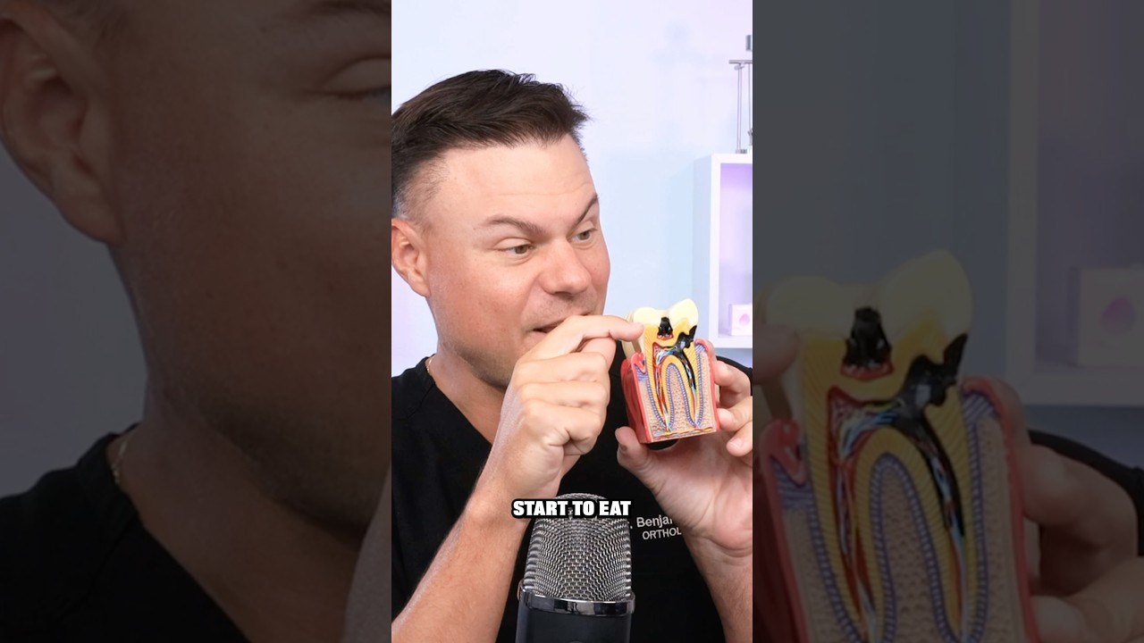 Dentist Reveals What ACTUALLY Causes Cavities! 😮🦷