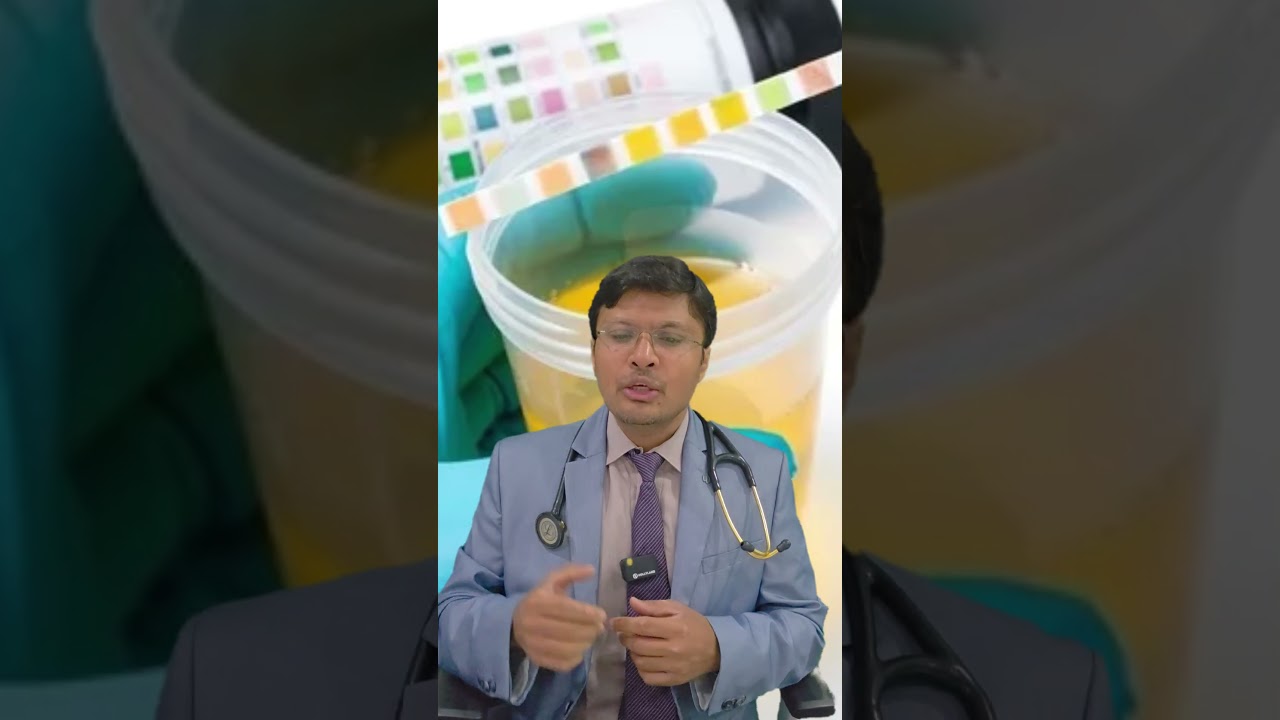 What tests should be done in hypertensive emergency | हाइपरटेंशन इमरजेंसी में जरूरी जांचें